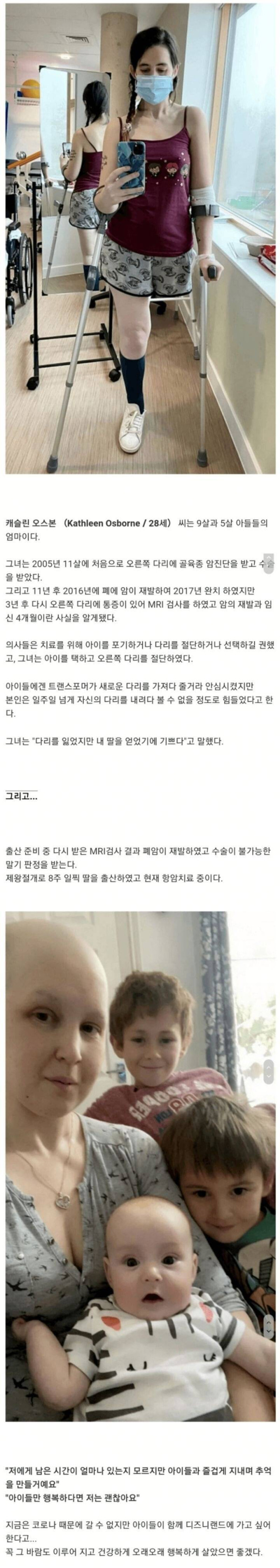 아이를 낳기 위해 다리를 절단한 임산부